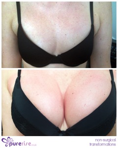 PureRise Transformations