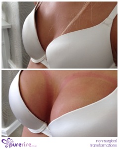 PureRise Transformations