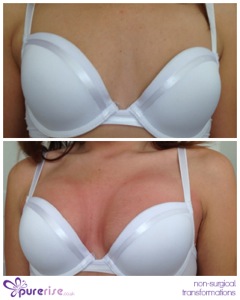 PureRise Transformations