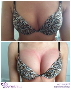 PureRise Transformations