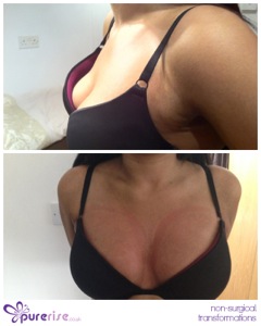 PureRise Transformations