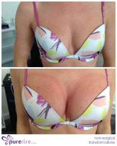 PureRise Transformations