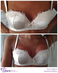 PureRise Transformations