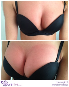 PureRise Transformations