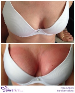 PureRise Transformations