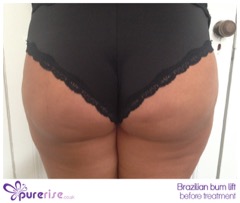 PureRise Transformations