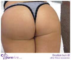 PureRise Transformations